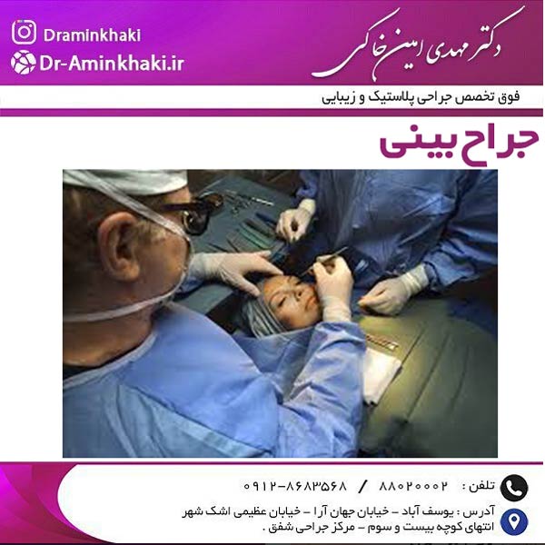 جراح بینی تهران