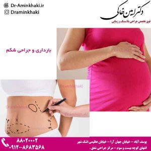 بارداری و جراحی شکم 