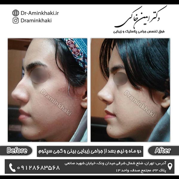 جراح بینی خوب در تهران